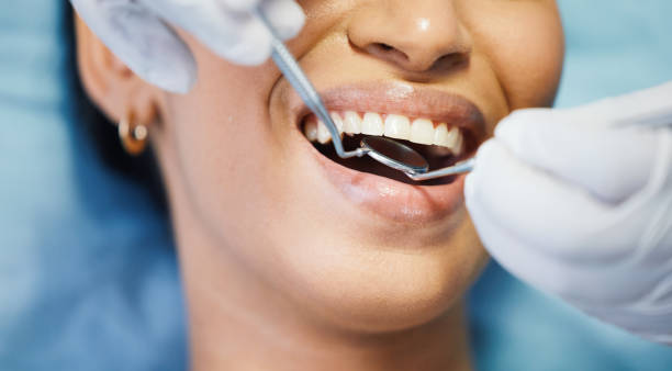 Best Emergency Root Canal Treatment in Combe, LA